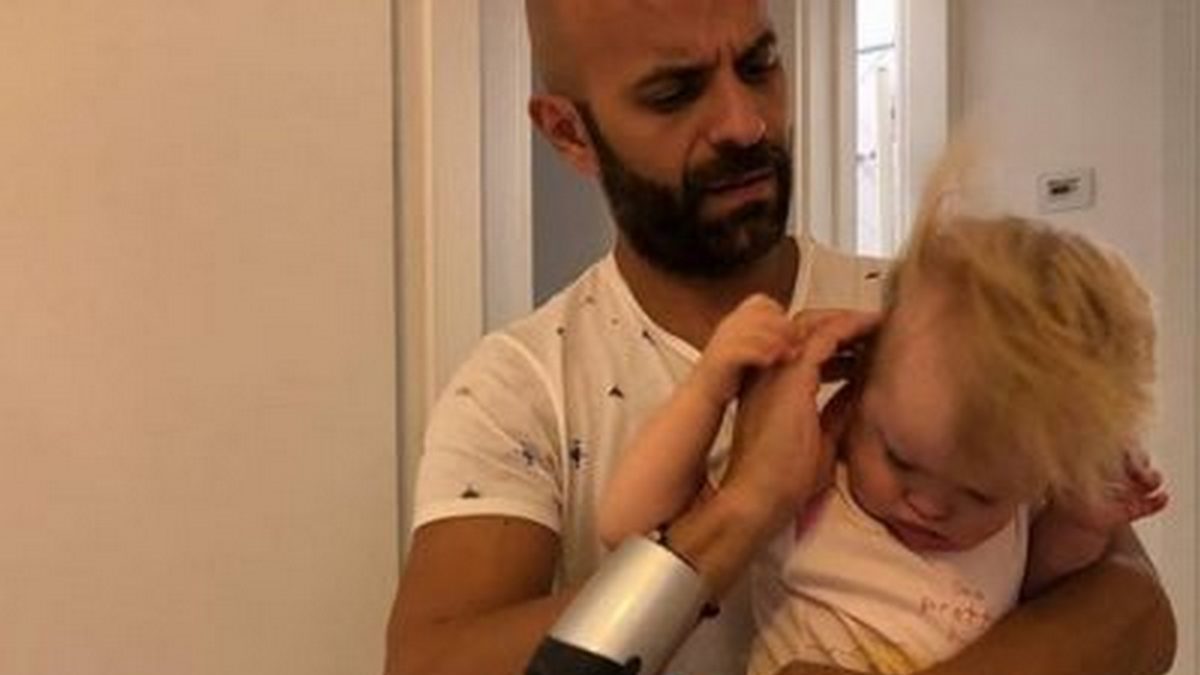 Una beba con síndrome de down fue rechazado por 20 familias pero un papa soltero la adoptó