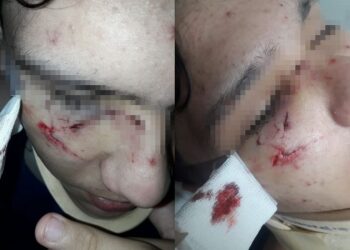 Salió de la escuela y una patota lo desfiguró a golpes