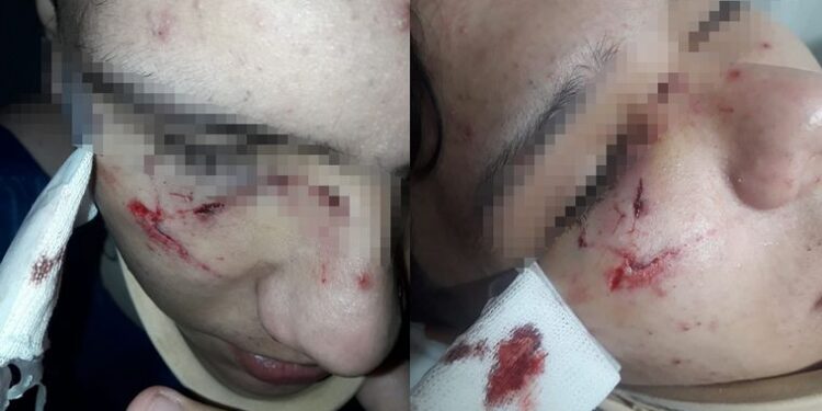 Salió de la escuela y una patota lo desfiguró a golpes