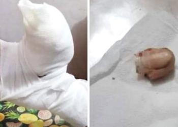 Policía se defendió de un ladrón y le cortó el dedo de un mordiscón