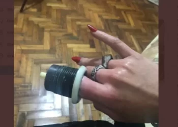 Se le quedó atascado el dedo en el inodoro y debió ser asistida por los bomberos