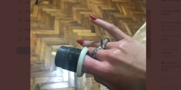 Se le quedó atascado el dedo en el inodoro y debió ser asistida por los bomberos