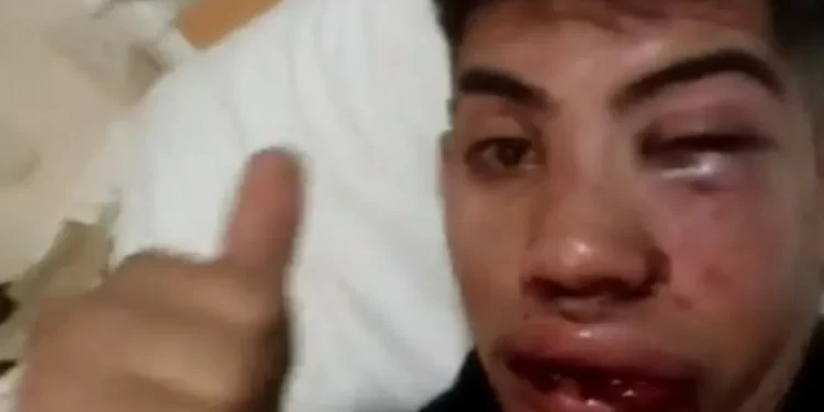 El video de la brutal paliza a un hombre tras una discusión de tránsito