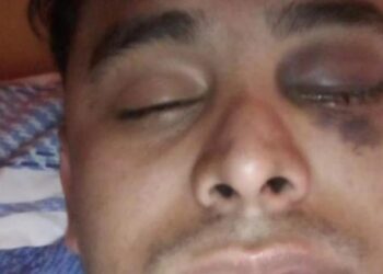 Violencia: se atrasó 15 días en el pago del alquiler y el dueño le hizo perder un ojo