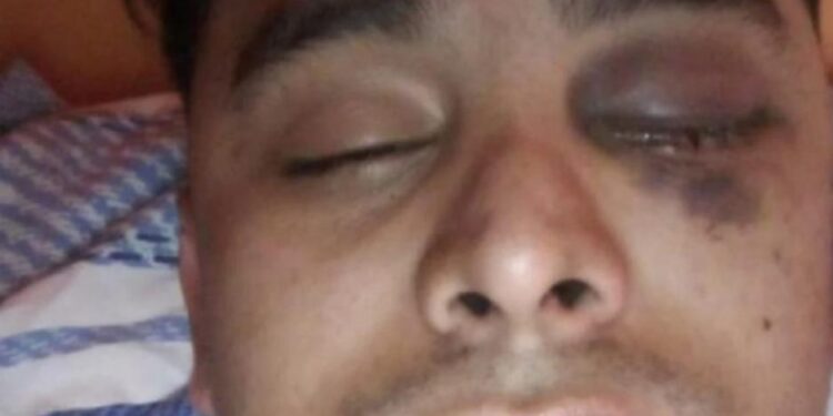 Violencia: se atrasó 15 días en el pago del alquiler y el dueño le hizo perder un ojo