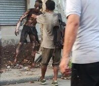 Rosario: intentó robar cables de alta tensión y terminó con el 90% del cuerpo quemado