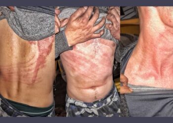 Sufrió un ataque de “algo invisible” que lo arrastró varios metros