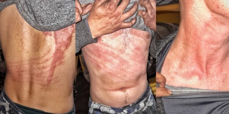 Sufrió un ataque de “algo invisible” que lo arrastró varios metros