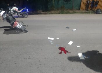 Violento accidente en Rawson deja a motociclista con fractura expuesta