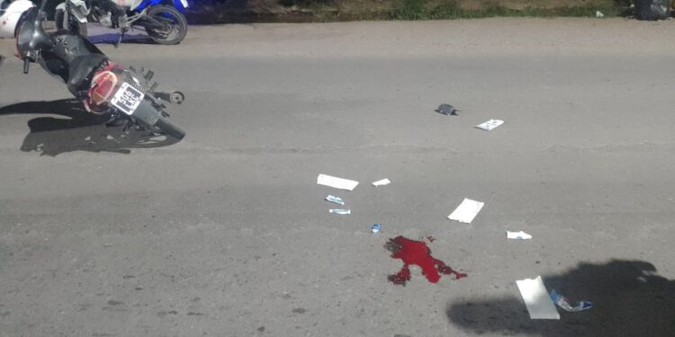 Violento accidente en Rawson deja a motociclista con fractura expuesta