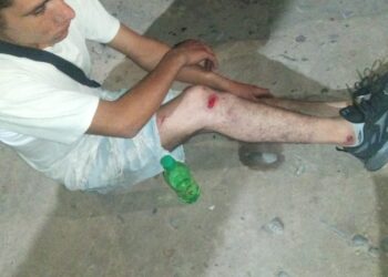 Choque y fuga en Chimbas: Moto embiste a una ciclista tras ser rozado por otra moto
