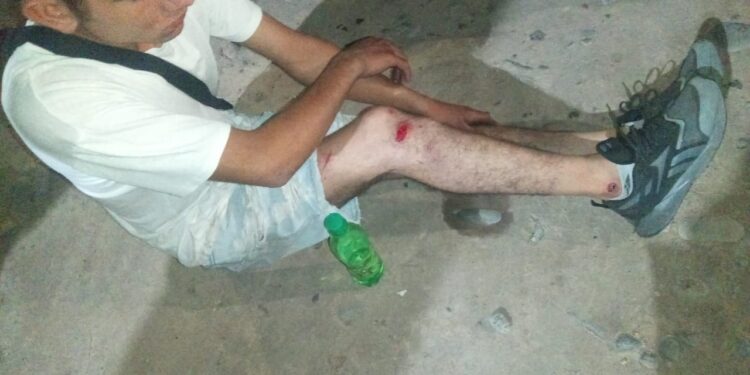 Choque y fuga en Chimbas: Moto embiste a una ciclista tras ser rozado por otra moto