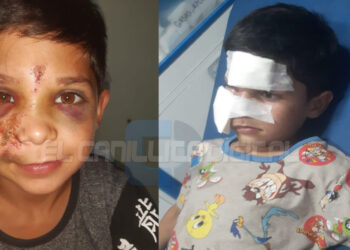 Niño de 8 años fue golpeado mientras paseaba en bicicleta: buscan al agresor