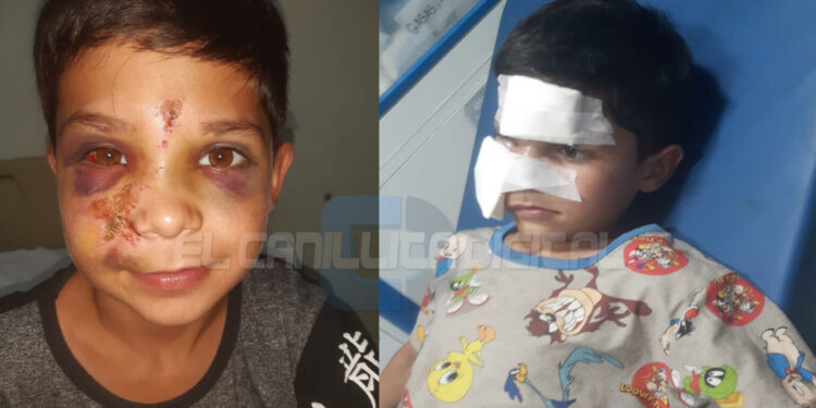 Niño de 8 años fue golpeado mientras paseaba en bicicleta: buscan al agresor