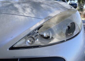 Tragedia en Rivadavia: un niño sufrió fractura tras ser atropellado por un auto