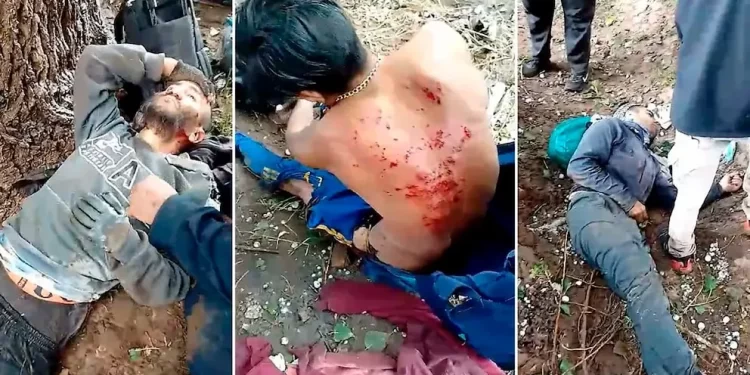 Cosechadores fueron heridos por un rayo mientras estaban abajo de un árbol