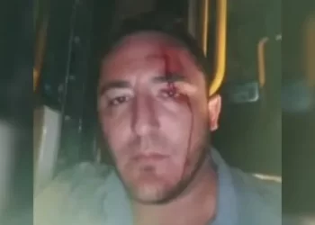 Terror en Rivadavia: atacaron a un colectivero y lo dejaron ensangrentado