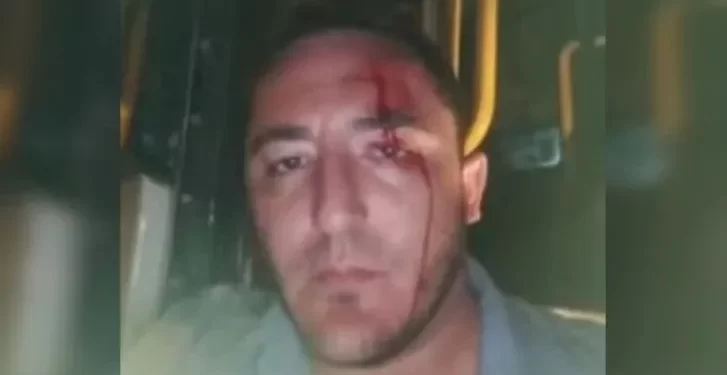Terror en Rivadavia: atacaron a un colectivero y lo dejaron ensangrentado