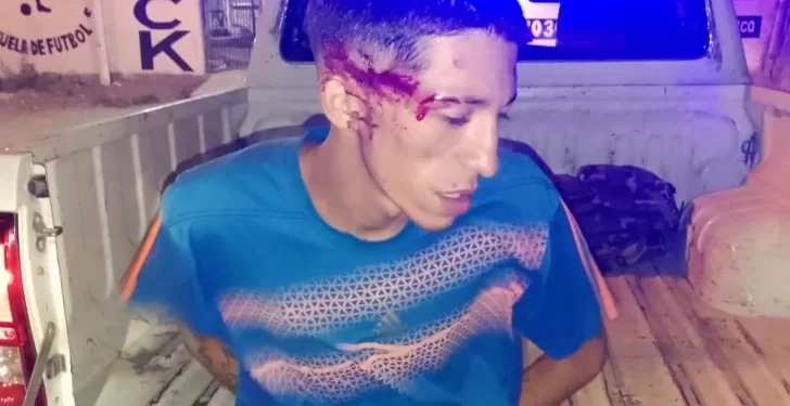 El “Chinchulín” Rojas quiso robar en Rawson, pero los vecinos lo redujeron a golpes