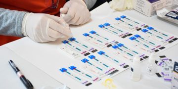 Salud informa los lugares donde realizan testeos gratuitos de Hepatitis