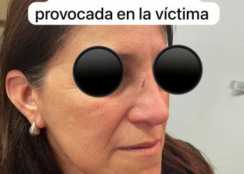 Golpes y tirones de cabello: así quedó una directora tras paliza de madre e hija