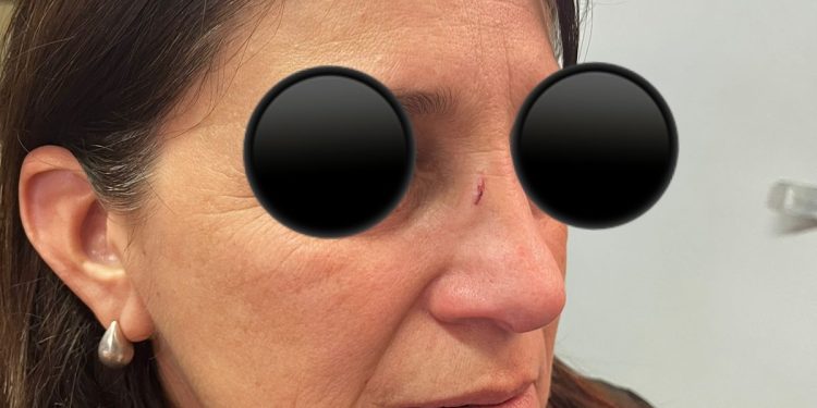 Golpes y tirones de cabello: así quedó una directora tras paliza de madre e hija