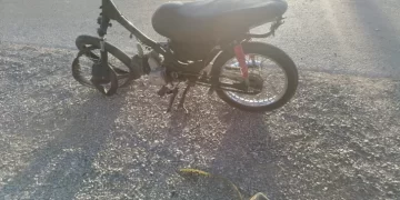 Un motociclista de 19 años resultó herido tras chocar contra un auto