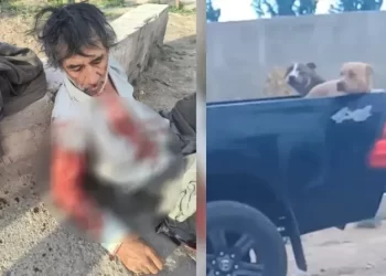 Ataque brutal de dos pitbulls dejó a un trabajador gravemente herido