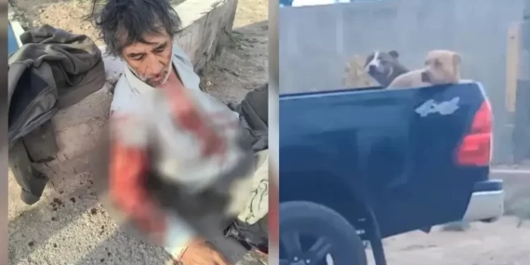 Ataque brutal de dos pitbulls dejó a un trabajador gravemente herido