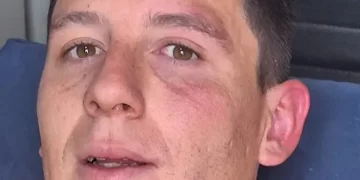 Brutal agresión en una semifinal de la Liga Albardón-Angaco: suspendieron el partido tras un violento ataque a un arquero