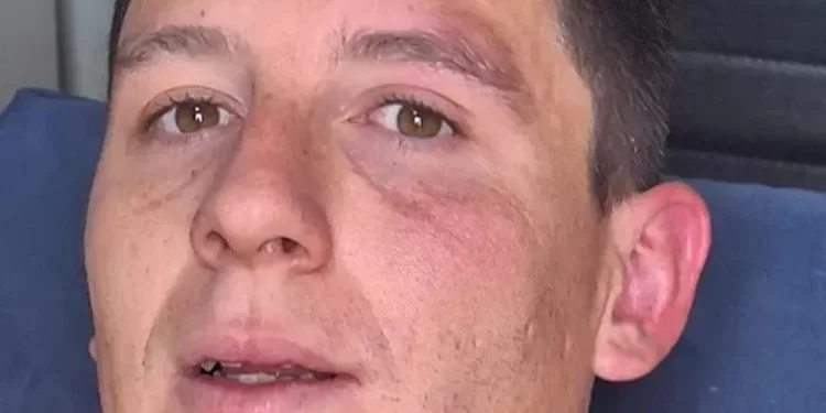 Brutal agresión en una semifinal de la Liga Albardón-Angaco: suspendieron el partido tras un violento ataque a un arquero