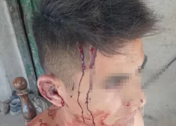 Entraron armados con falsas camperas de la PFA y golpearon a un hombre: le robaron $150 mil