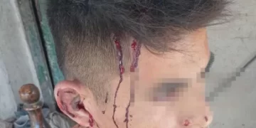 Entraron armados con falsas camperas de la PFA y golpearon a un hombre: le robaron $150 mil