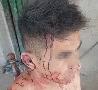 Entraron armados con falsas camperas de la PFA y golpearon a un hombre: le robaron $150 mil