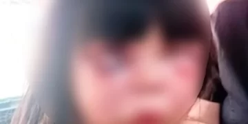 Golpiza a una nena de 7 años: el agresor fue detenido