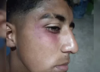 Un jugador de Atlético Sarmiento resultó herido por pirotecnia durante un partido