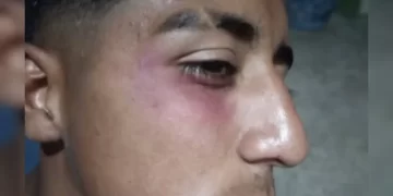 Un jugador de Atlético Sarmiento resultó herido por pirotecnia durante un partido