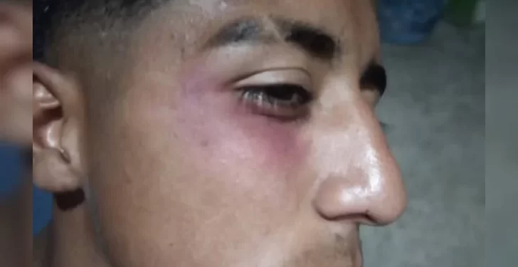 Un jugador de Atlético Sarmiento resultó herido por pirotecnia durante un partido