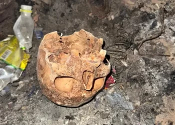 Misterioso hallazgo en Albardón: encontraron un cráneo en un basural y hay investigación en marcha