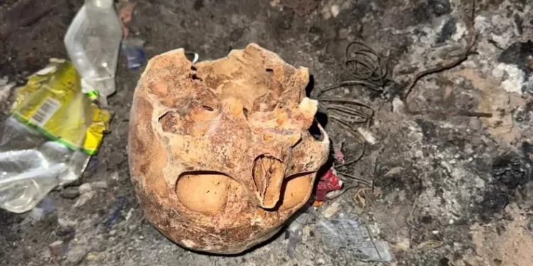 Misterioso hallazgo en Albardón: encontraron un cráneo en un basural y hay investigación en marcha