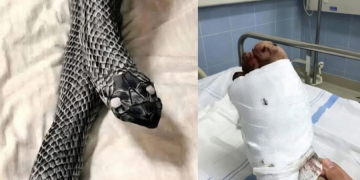 Confundió el pie de su esposa con una víbora y la golpeó: terminó fracturada