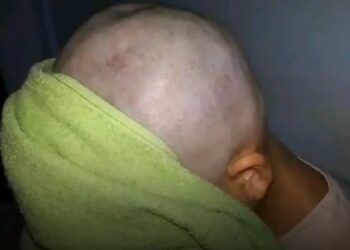Le rapó el cabello a su hija tras acusarla de hacerle bullying a una compañera con cáncer