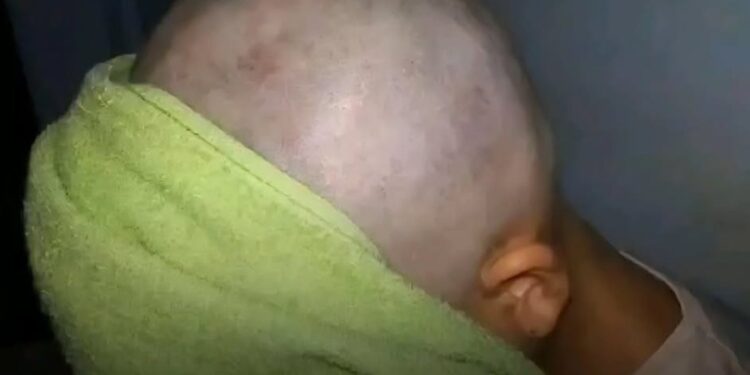 Le rapó el cabello a su hija tras acusarla de hacerle bullying a una compañera con cáncer