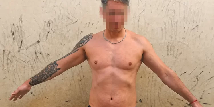 Un hombre golpeó, apuñaló y trató de abusar de su pareja