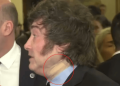 El misterio de la venda en el cuello: por qué apareció lesionado Javier Milei