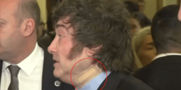 El misterio de la venda en el cuello: por qué apareció lesionado Javier Milei